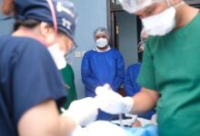 Lima Anak di Sulsel Ikut Operasi Gratis Celah Bibir Sumbing di Gowa