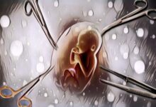 Polda Bali Jadikan Seorang Dokter Gigi Tersangka Kasus Aborsi Terhadap 1.338 Perempuan