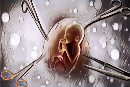 Polda Bali Jadikan Seorang Dokter Gigi Tersangka Kasus Aborsi Terhadap 1.338 Perempuan