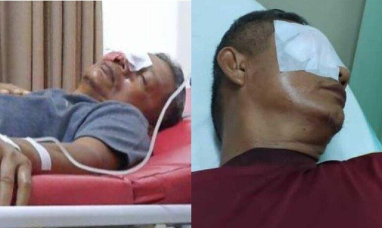 Begini Kondisi dan Kronologi Guru Penjas Yang Dianiaya Orang Tua Murid Hingga Manatanya Terancam Buta