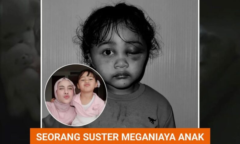 Anak Selebgram Emy Aghnia Korban Kekerasan Suster Pengasuh