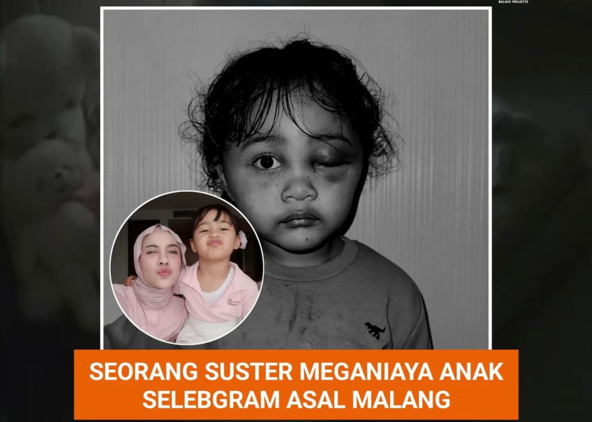 Anak Selebgram Emy Aghnia Korban Kekerasan Suster Pengasuh