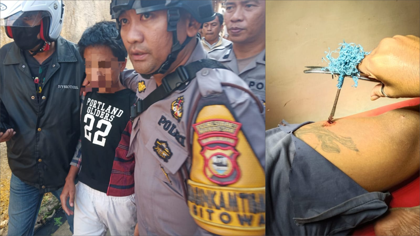 Remaja 16 Tahun Serang Seorang Pria Pakai Anak Panah